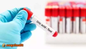 الفرق بين اليوريا واليوريك اسيد